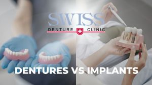 dentures-vs-implants-calgary